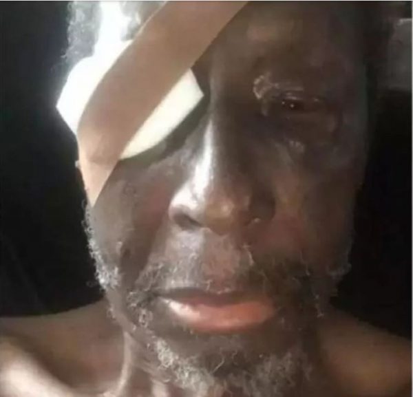 New photo shows veteran actor, Sadiq Daba is about to loose his eye