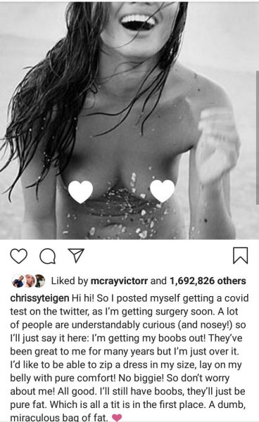 Why I am removing my breast implants - Chrissy Teigen