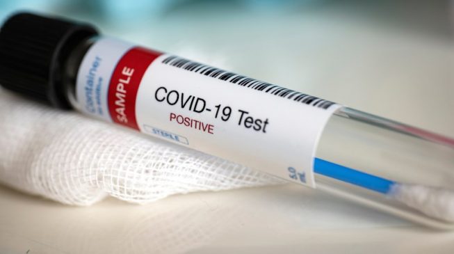 Man,wife, and three-year-old child test positive for COVID-19 in Ebonyi