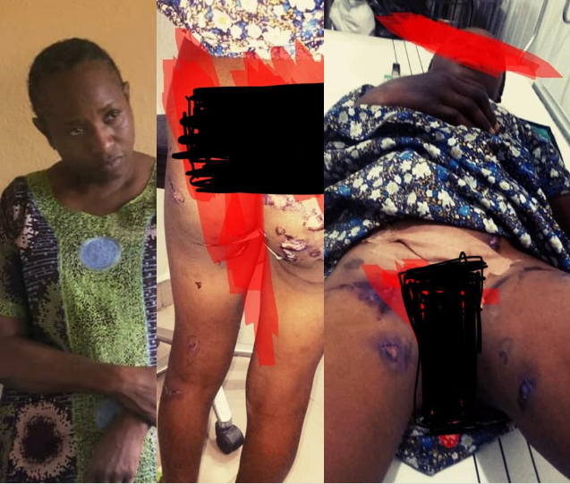 Deaconess Iyema Oyemola Oyewole burns ward’s vagina with lighter topnaija.ng 1