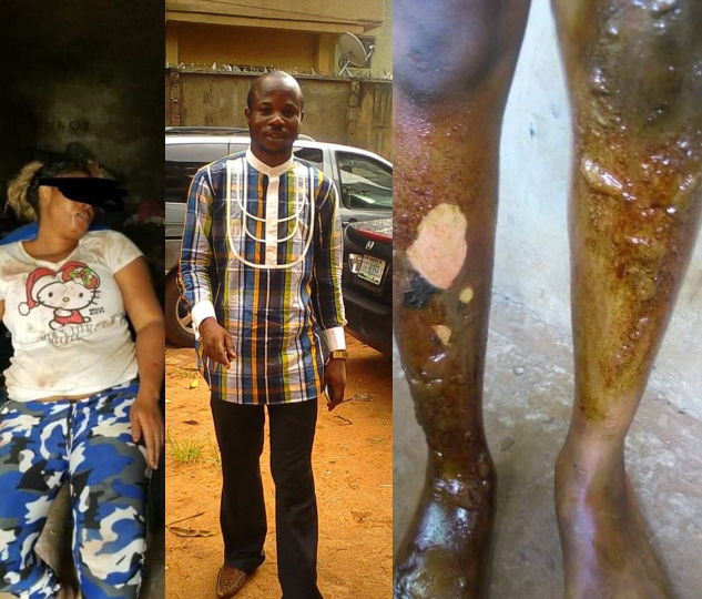 Man allegedly burns wife's skin after accusing her of gossiping