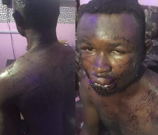 River State: Man allegedly brutalized and almost shot by soldiers who mistook him for someone else-TopNaija.ng