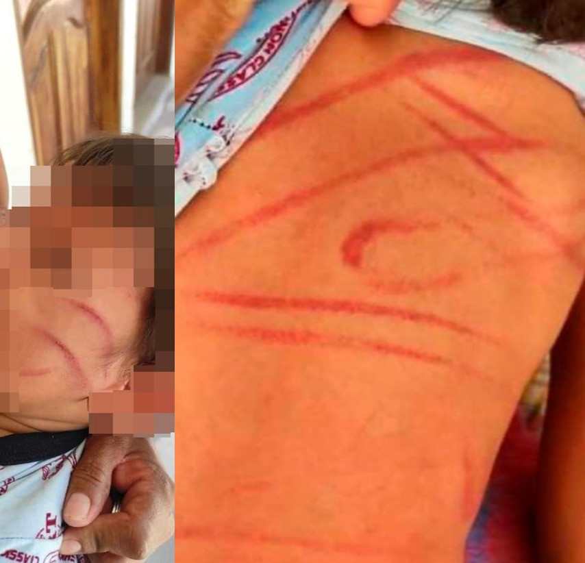 Woman is accused of brutally whipping a two-year-old boy 'with metal wire' -TopNaija.ng