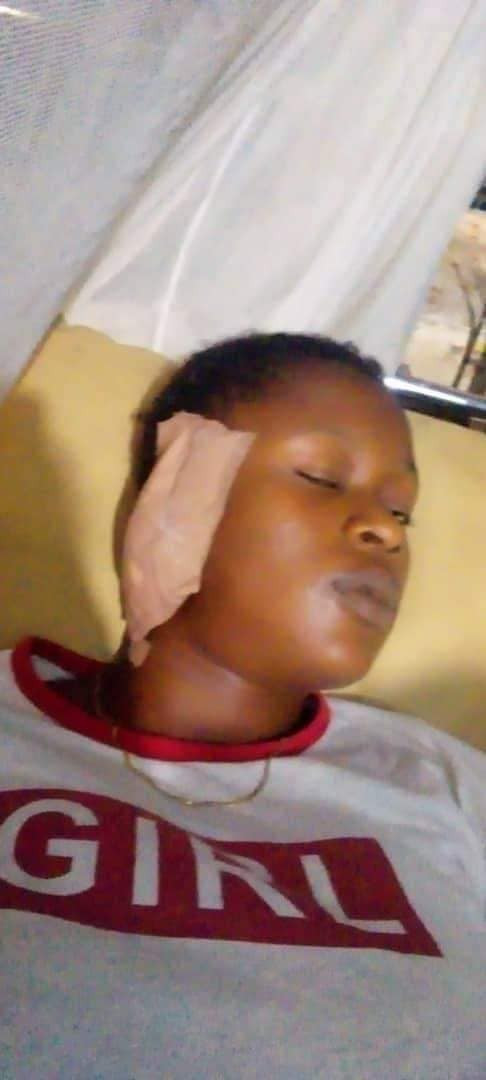 How Retired police officer allegedly bitten off 18-year-old girl's ear in Edo -TopNaija.ng