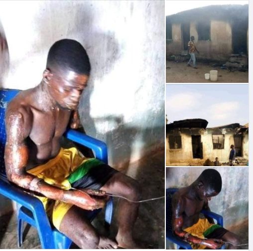 Benue state: Lady sets husband ablaze in their rented apartment -TopNaija.ng