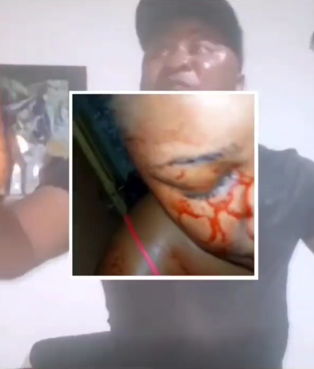 Man allegedly beats up his partner till she bleeds-TopNaija.ng