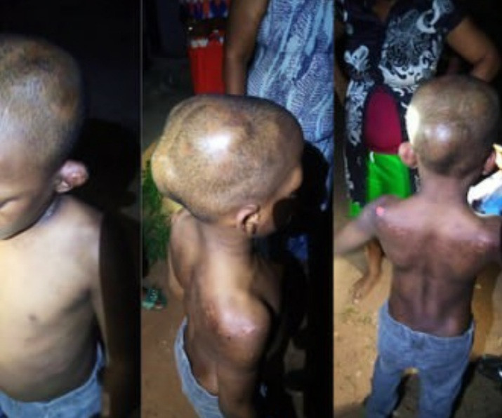 Police arrest woman for brutalizing her biological son and locking him up for months-TopNaija.ng