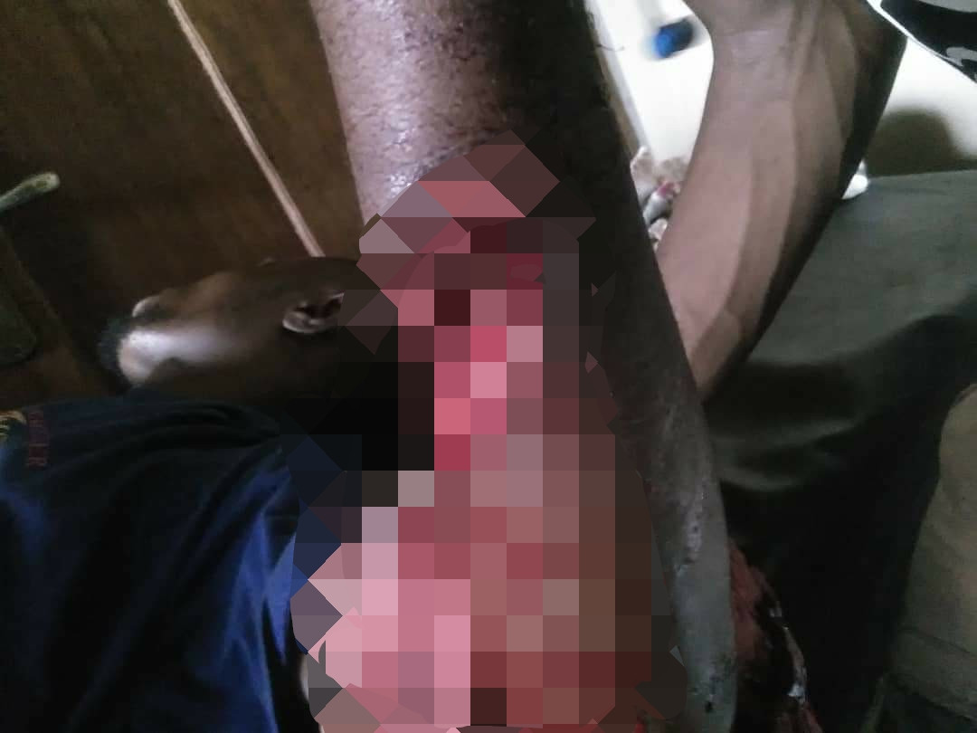 How angry customer inflicted deep machete cut on electricity official in Enugu (graphic photo)-TopNaija.ng