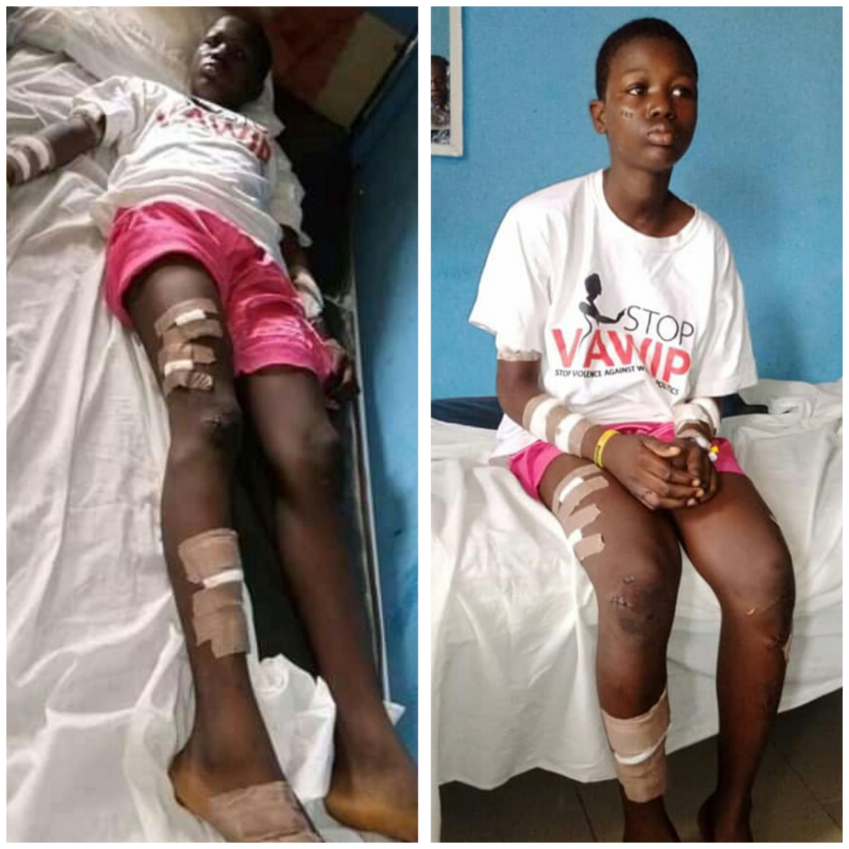 Nigerian woman slashes her 13-year-old daughter with razor blade over alleged theft of N1,500 in Bayelsa-TopNaija.ng