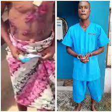 Man arrested for allegedly torturing his stepson with hot knife over N20 theft in Edo -TopNaija.ng