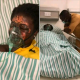 Ghanaian man allegedly bathes wife with acid in Ghana-TopNaija.ng