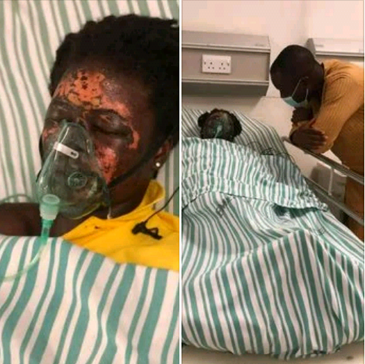 Ghanaian man allegedly bathes wife with acid in Ghana-TopNaija.ng