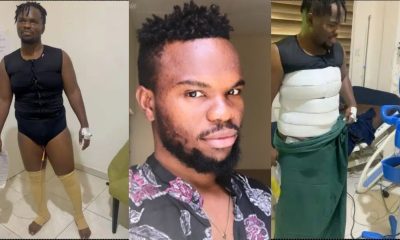 Blogger, Tosin Silverdam recovers from liposuction surgery (Video)