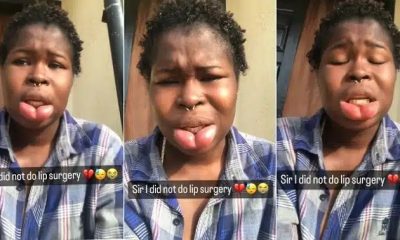 “I’ve spent a lot of money” – Lady whose lips got swollen 2 years ago says she never did surgery [Video]