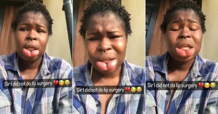 “I’ve spent a lot of money” – Lady whose lips got swollen 2 years ago says she never did surgery [Video]