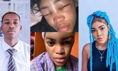 "Lil Frosh is lying, it wasn’t allergic reaction" – Cute Gemini shares images