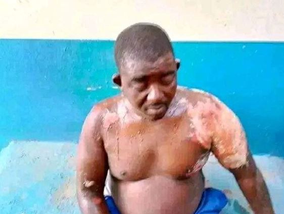 Newly wedded wife pours boiling water on man for preventing her from calling other men