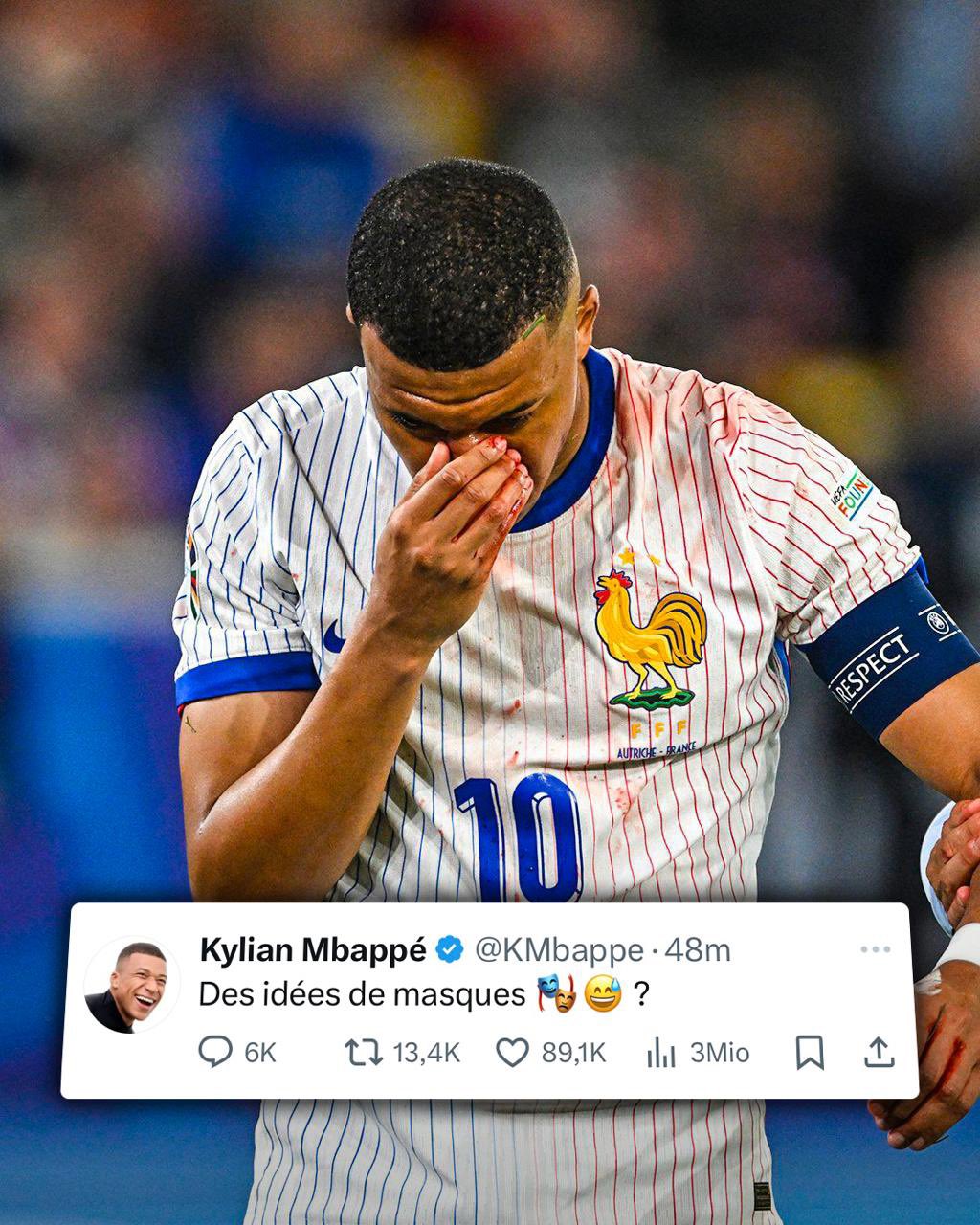 Kylian Mbappé to miss immediate action due to Nose Fracture