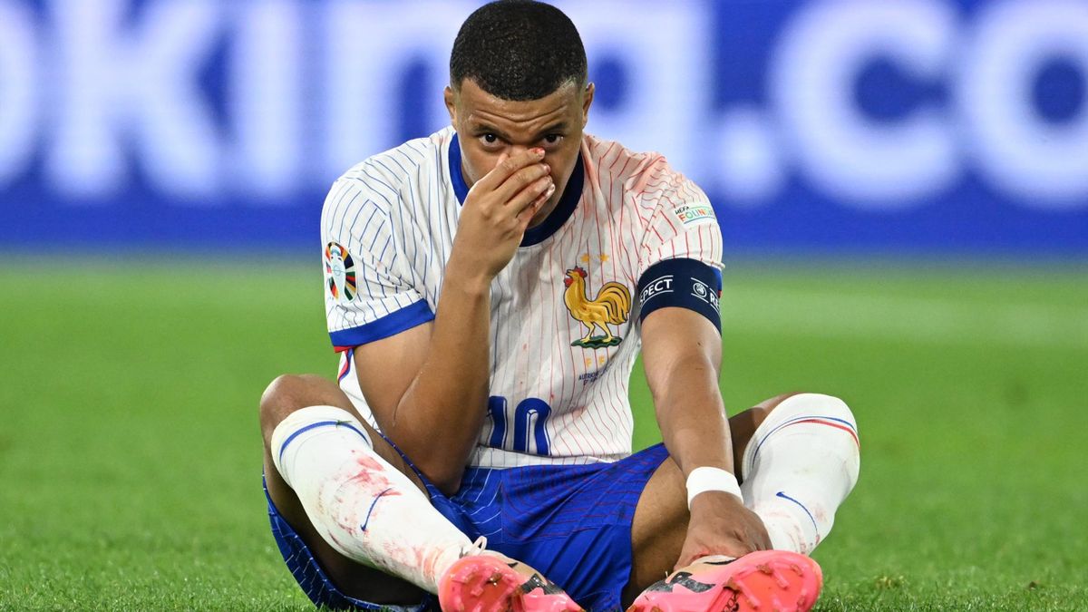 Kylian Mbappé to miss immediate action due to Nose Fracture