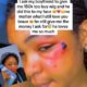 Lady shares bruises she got after asking her man for N150K (VIDEO)